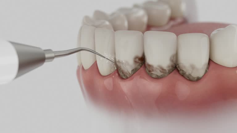 Reliable Dental contractor in Huntington, IN by Dentist Open Now